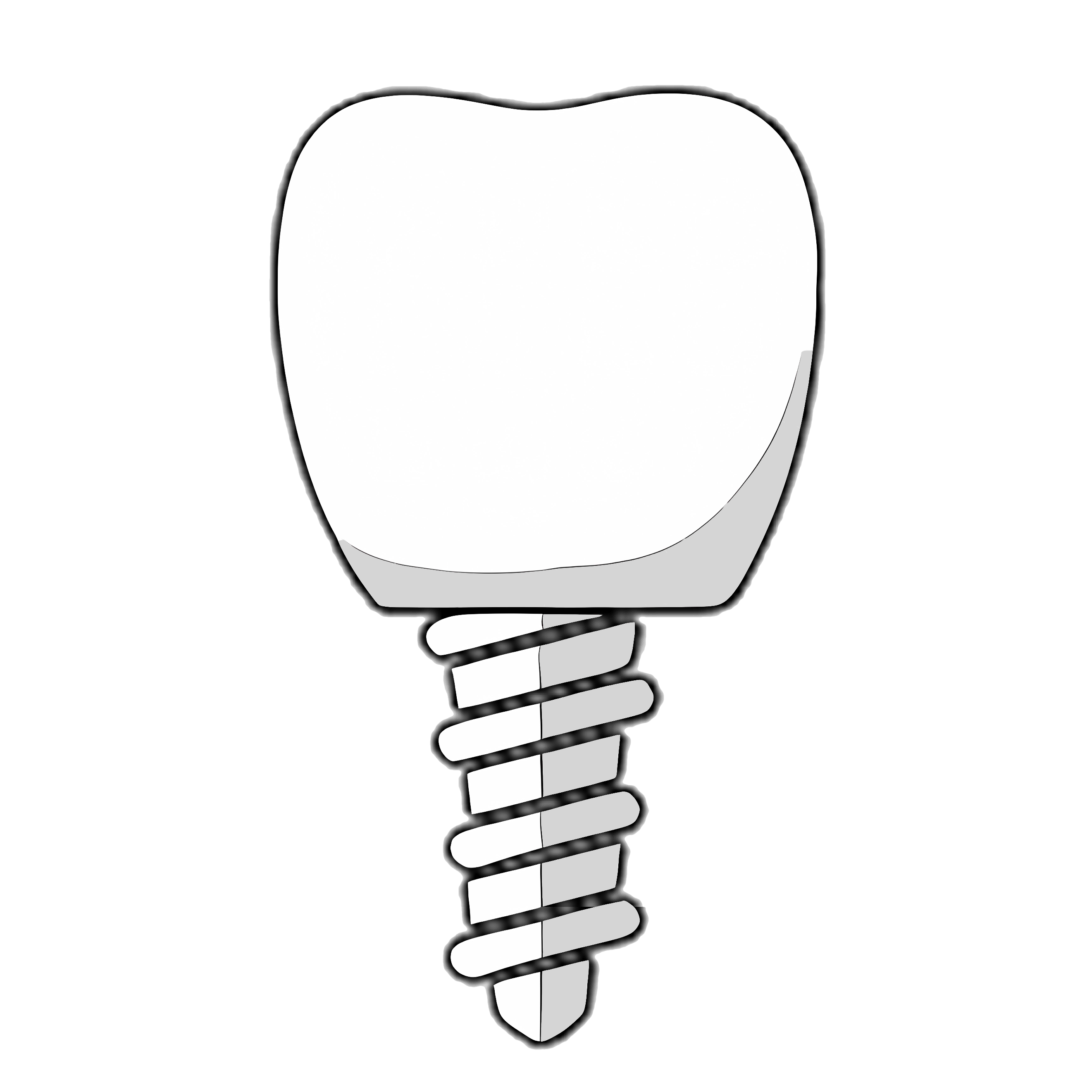 Dental Implants 種植牙配件
